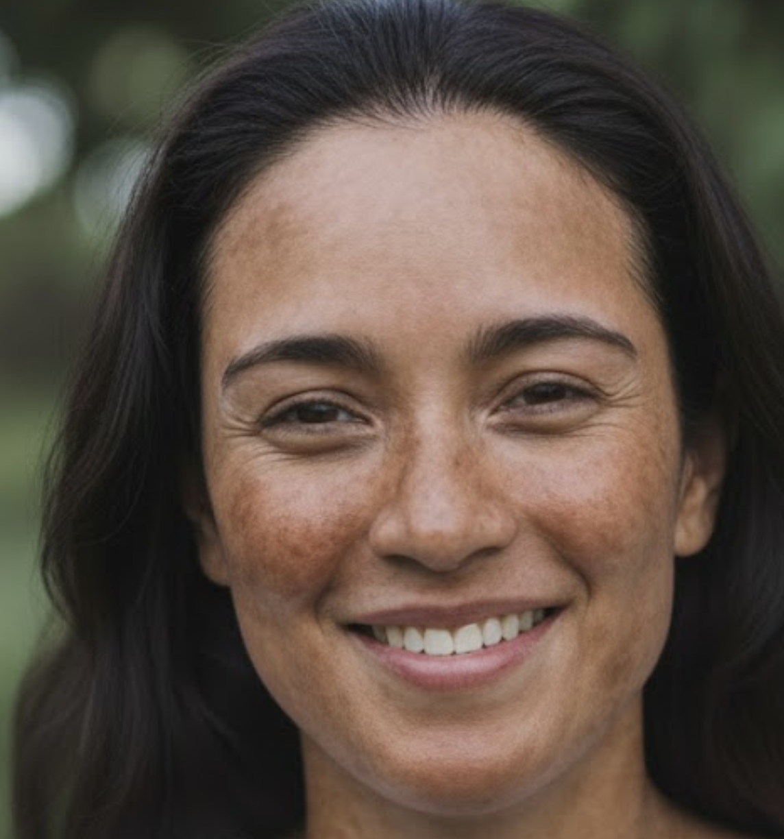 044- Pesquisa com sérum facial para melasma